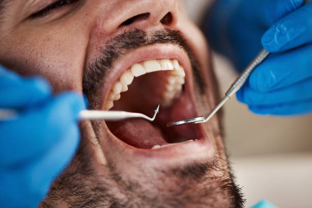 Best Teeth Whitening  in Bright, IN